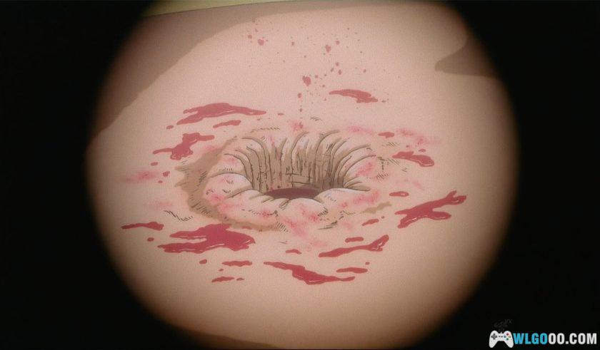 动画 怪医黑杰克OVA(1993)[12集][中文字幕]｜1080P高清-图片15