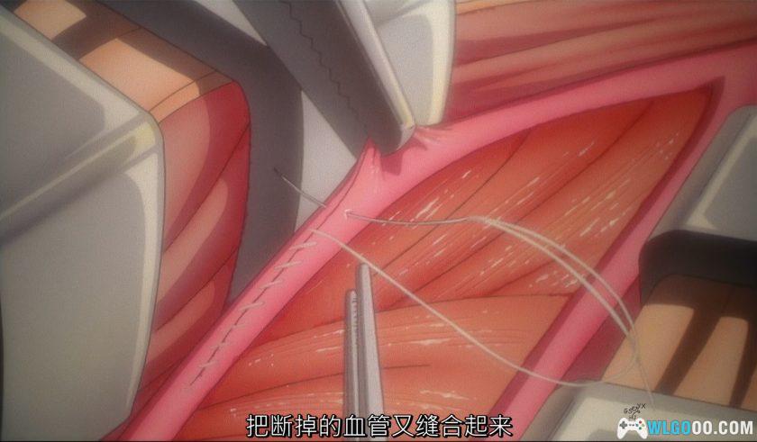 动画 怪医黑杰克OVA(1993)[12集][中文字幕]｜1080P高清-图片16